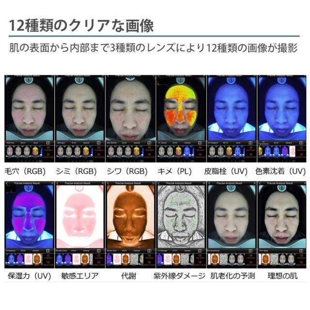 💛スマートミラープロ 肌分析機💛｜エステサロンお役立ちブログ