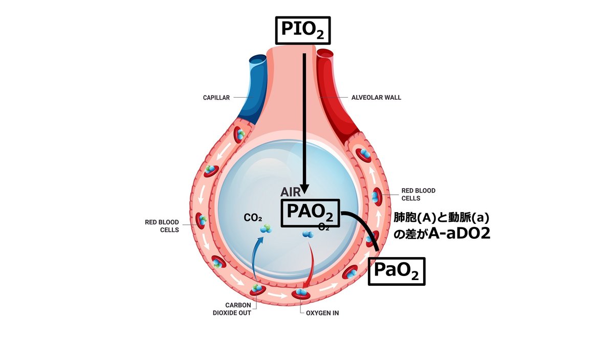 「A-aDO2」の計算式について｜Katsura, M.D.