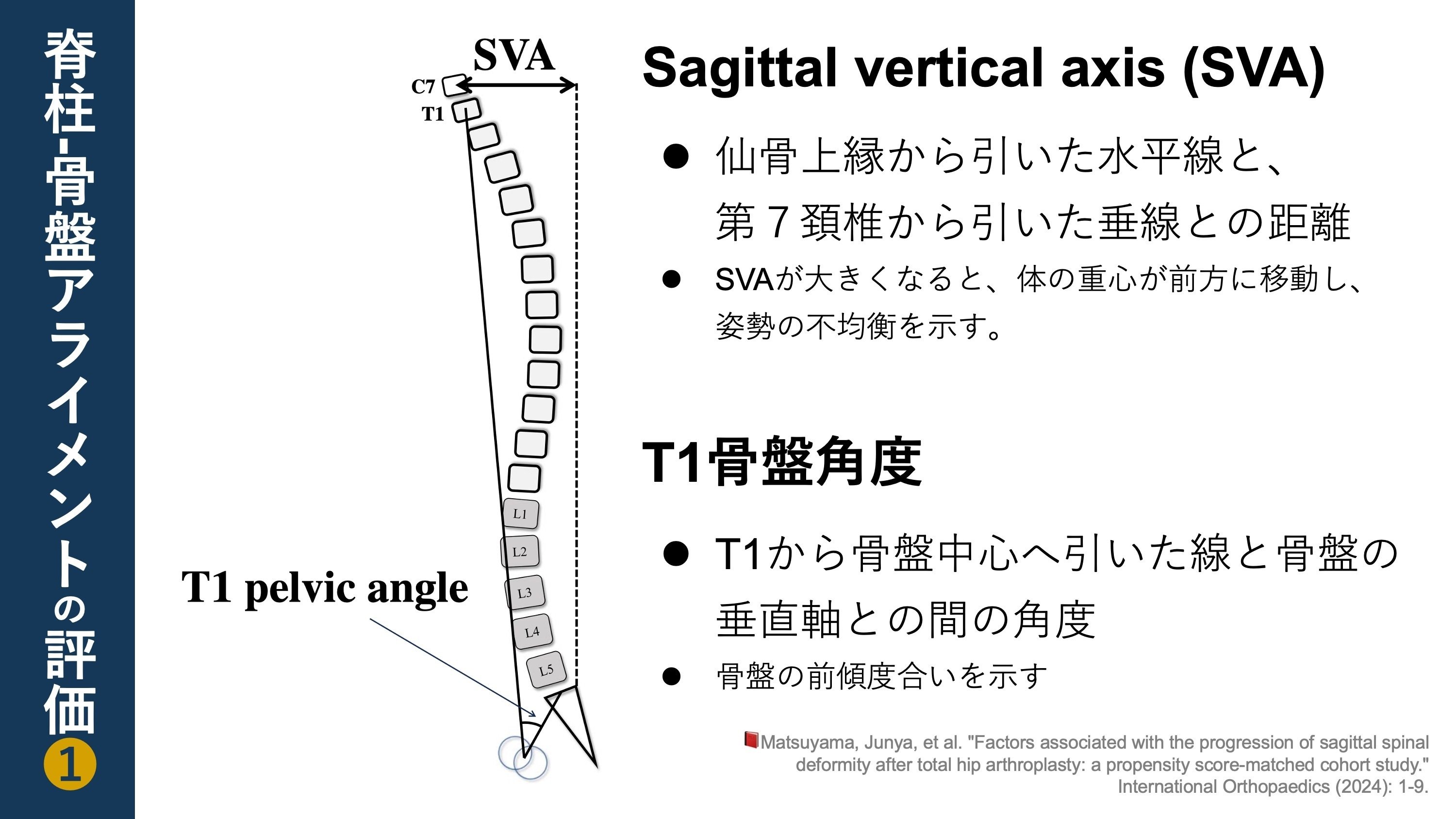 THA後の不良な矢状面姿勢。骨盤の形状が関連していた|Super THA後の不良な矢状面姿勢。骨盤の形状が関連していた|Super