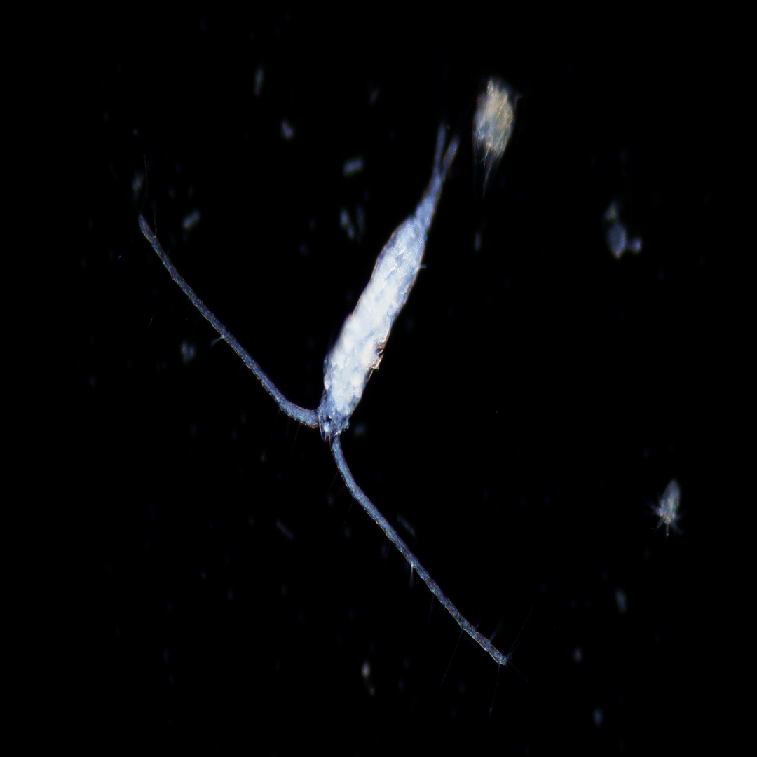 小さな小さなプランクトンの世界｜福井県衛生環境研究センター