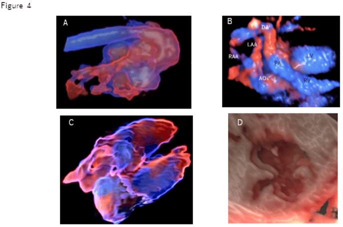 ここまで見える胎児心エコー検査｜☆近大小児科すくすくナビ〜こどもの