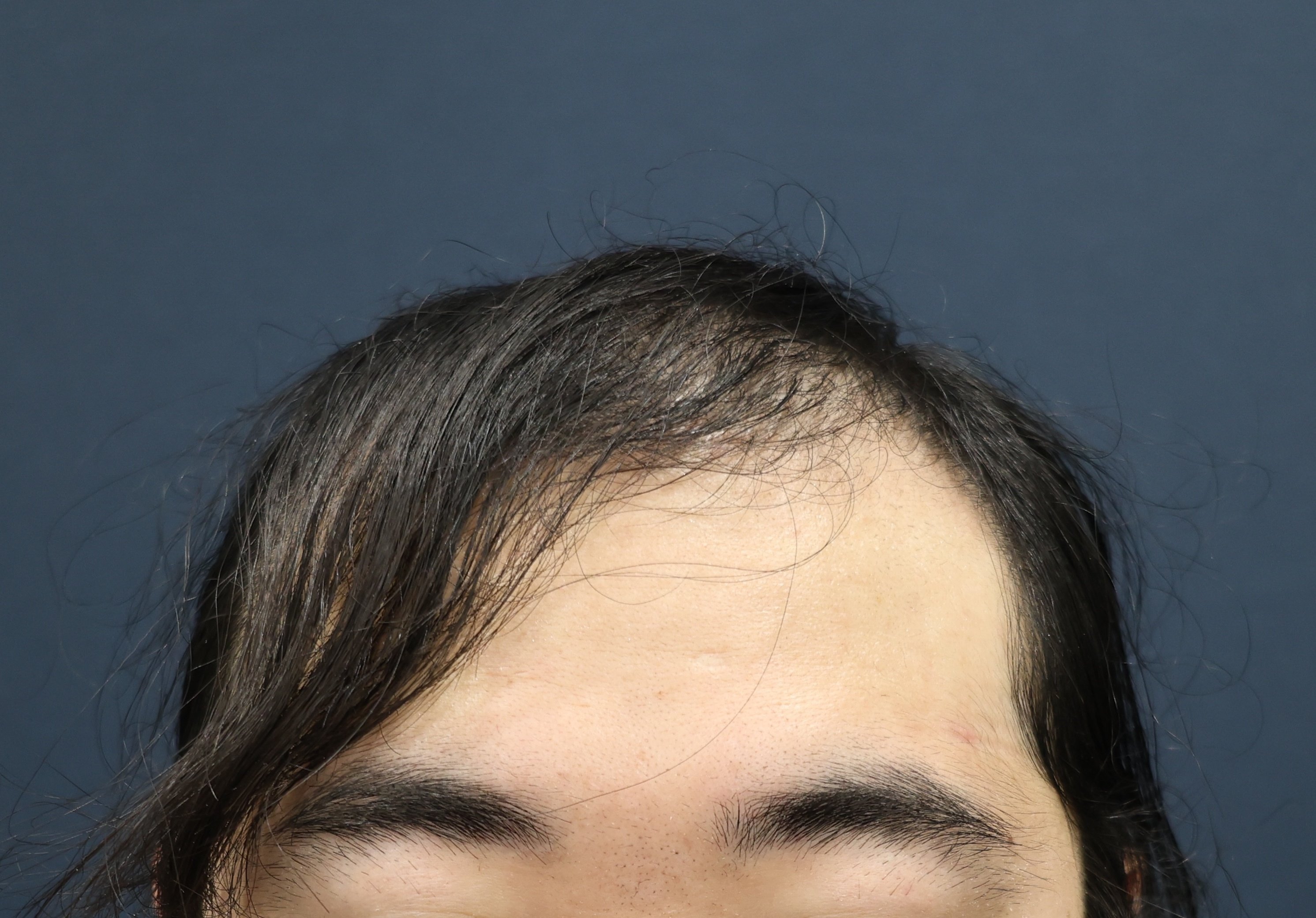 将来禿げる maxresdefault.jpg