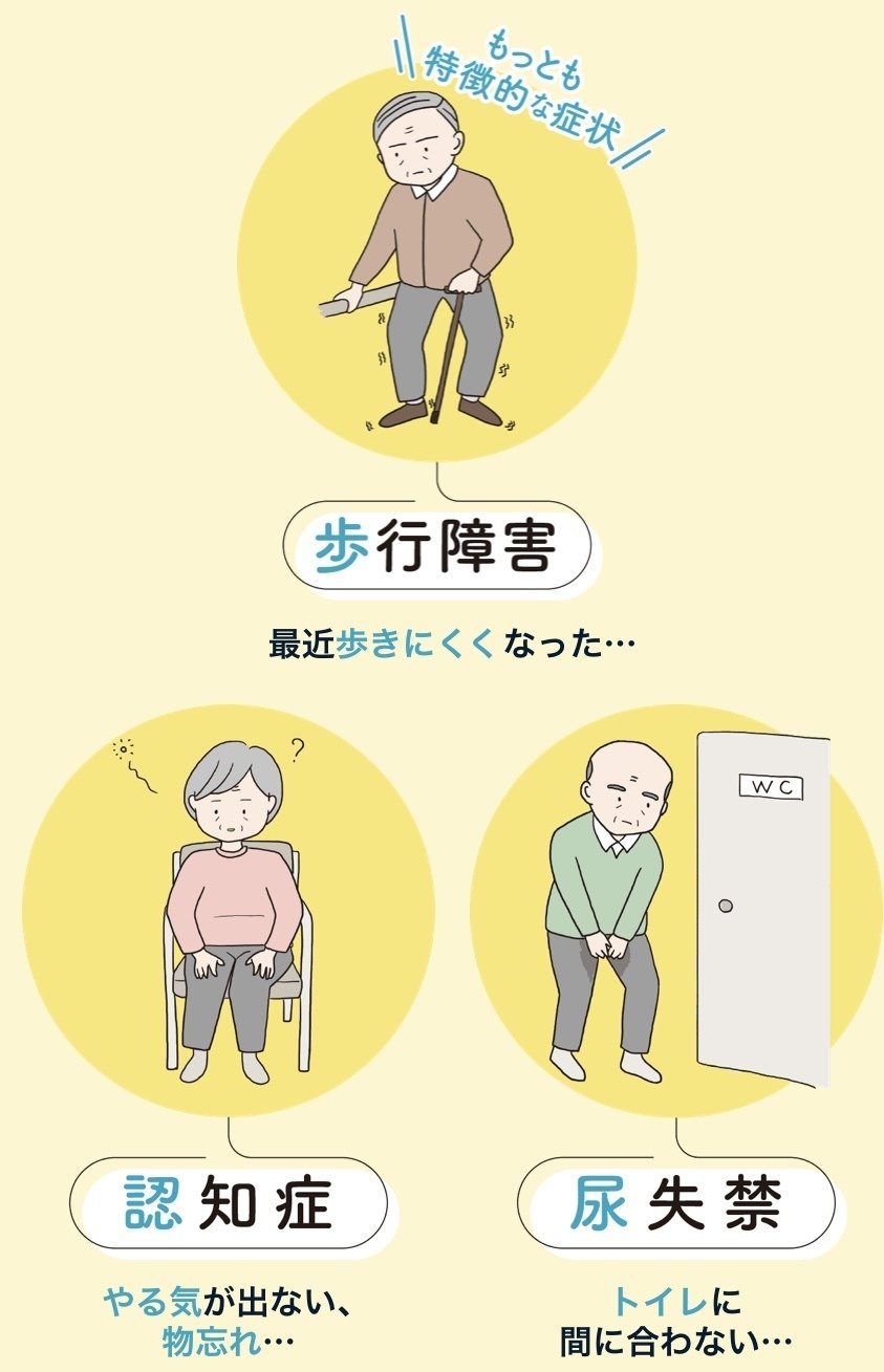 水頭症のひと 特発性正常圧水頭症（iNPH）。「手術で改善できる認知症」。主な