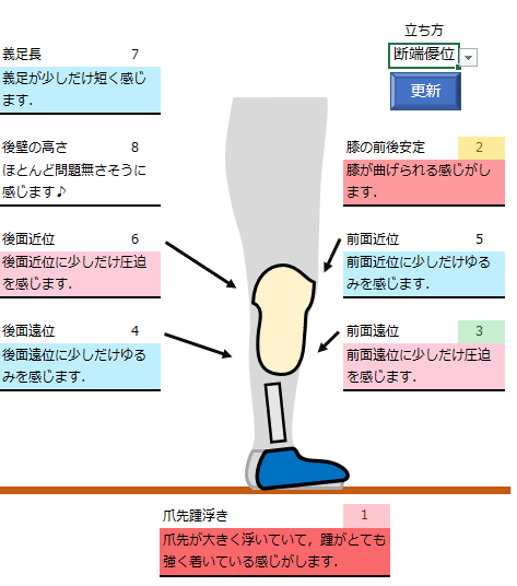 下腿義足：前方の不安定感1（膝折感）｜GAIT ASSIST