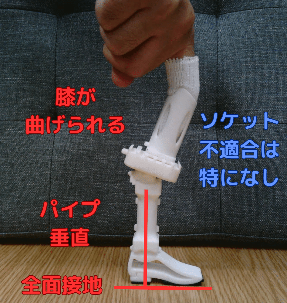 下腿義足：前方の不安定感1（膝折感）｜GAIT ASSIST