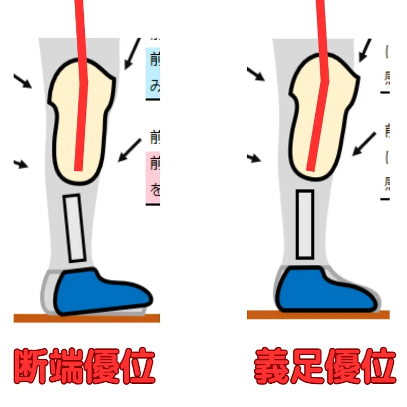 下腿義足：前方の不安定感2（膝折感）＜練習問題解説＞｜GAIT ASSIST