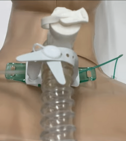 レスピセーフバンド」使用レビュー｜かわうそ