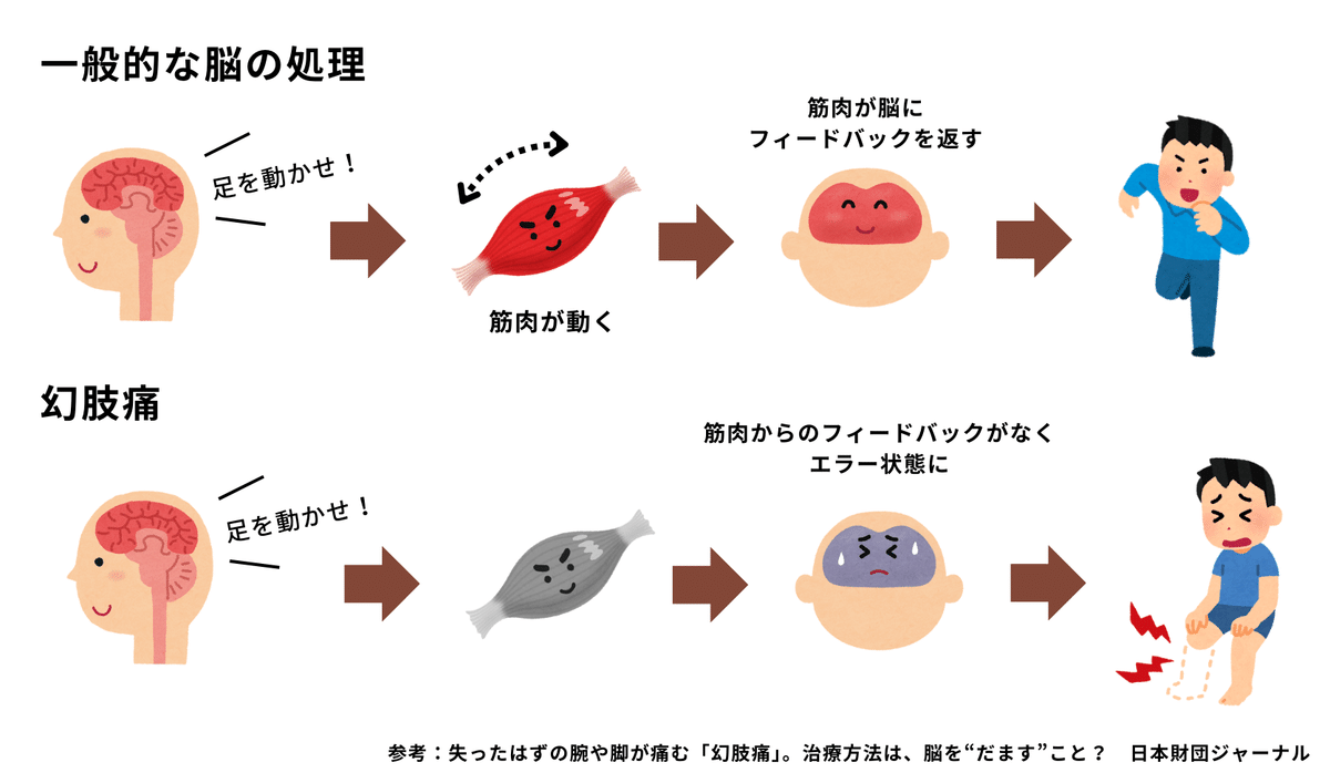 失った手足の痛みを感じる仕組み