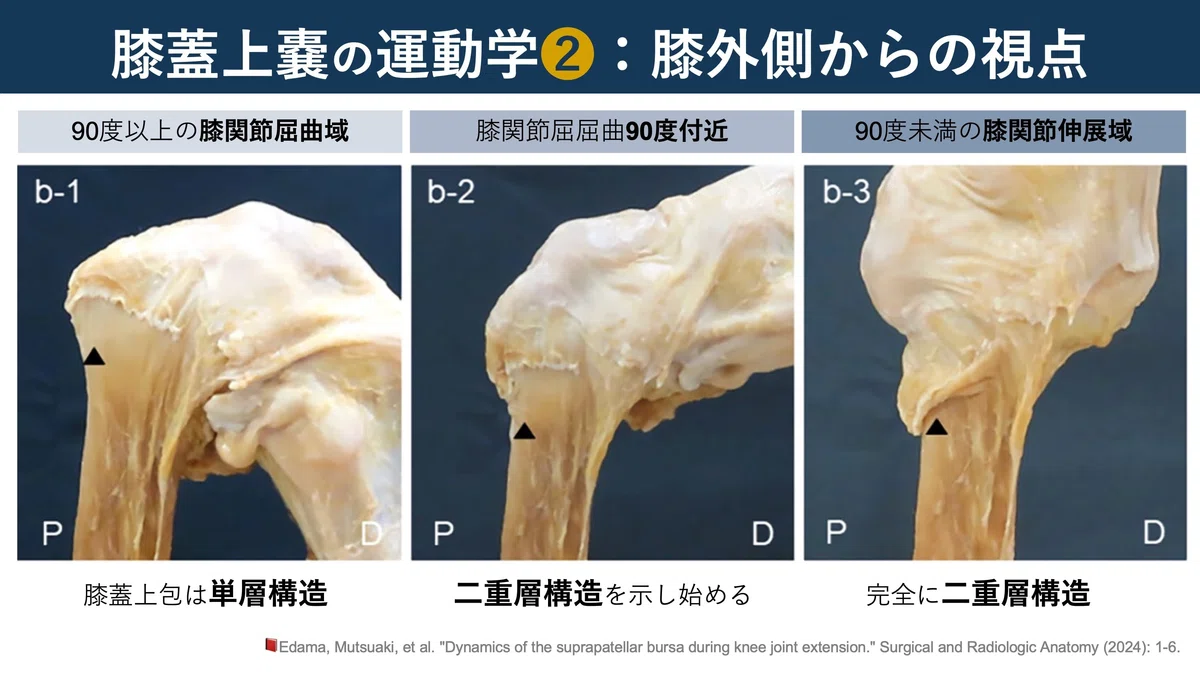 膝蓋上嚢の運動学|Super Human | 理学療法士/保健学博士 Ph.D.