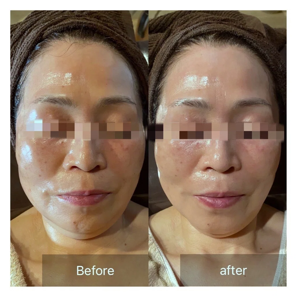 Eclat Beaute｜𝑇𝑒𝑖