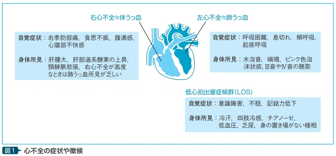 突撃!! 循環器診療についてショウジ先生に聞いてみた!】 第2回 ⼼不全