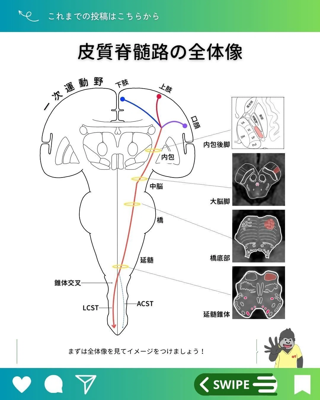 皮質脊髄路（錐体路）の走行とMRI読影｜サギョウ先生