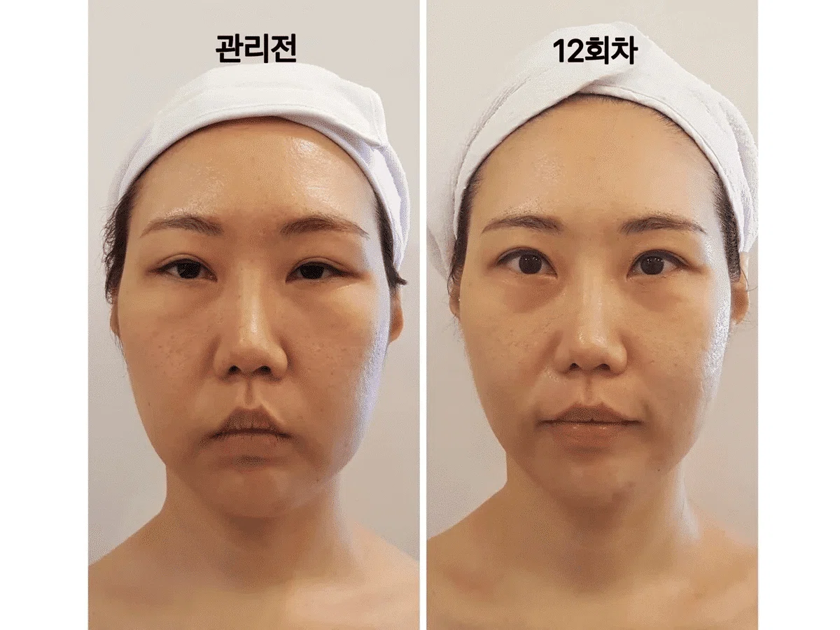 江南 「EHWA LA SPA(イファ・ラ・スパ)」