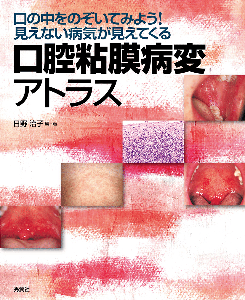 口腔内科学　教科書 2025年最新】口腔内科学の人気アイテム - メルカリ