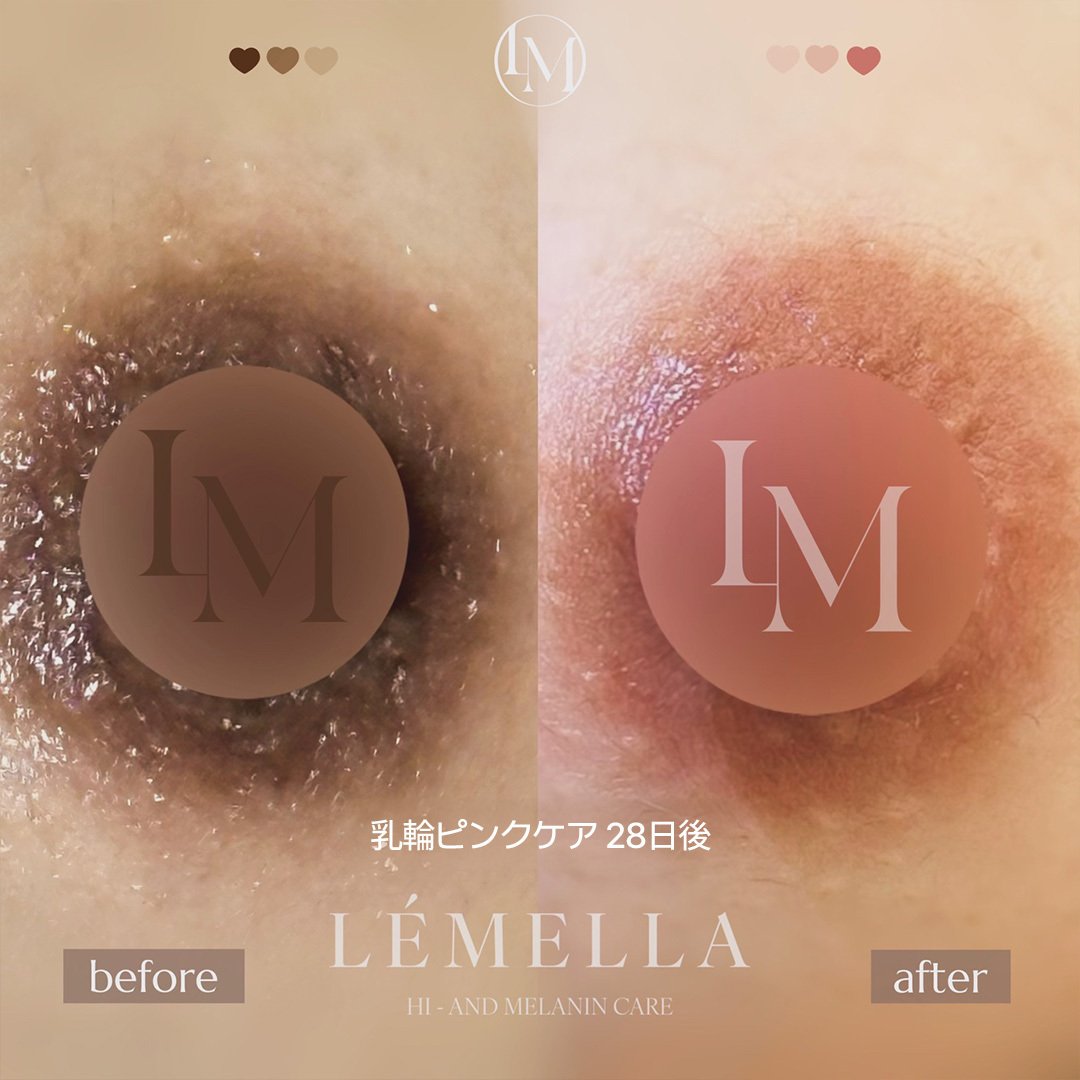 ピンクの乳輪 