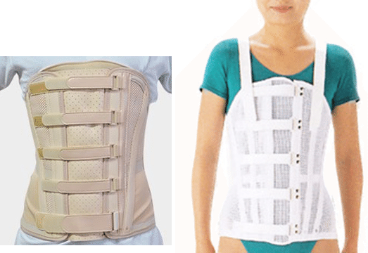 装具学 体幹装具 まとめ 胸腰仙椎装具｜じょんがらPT