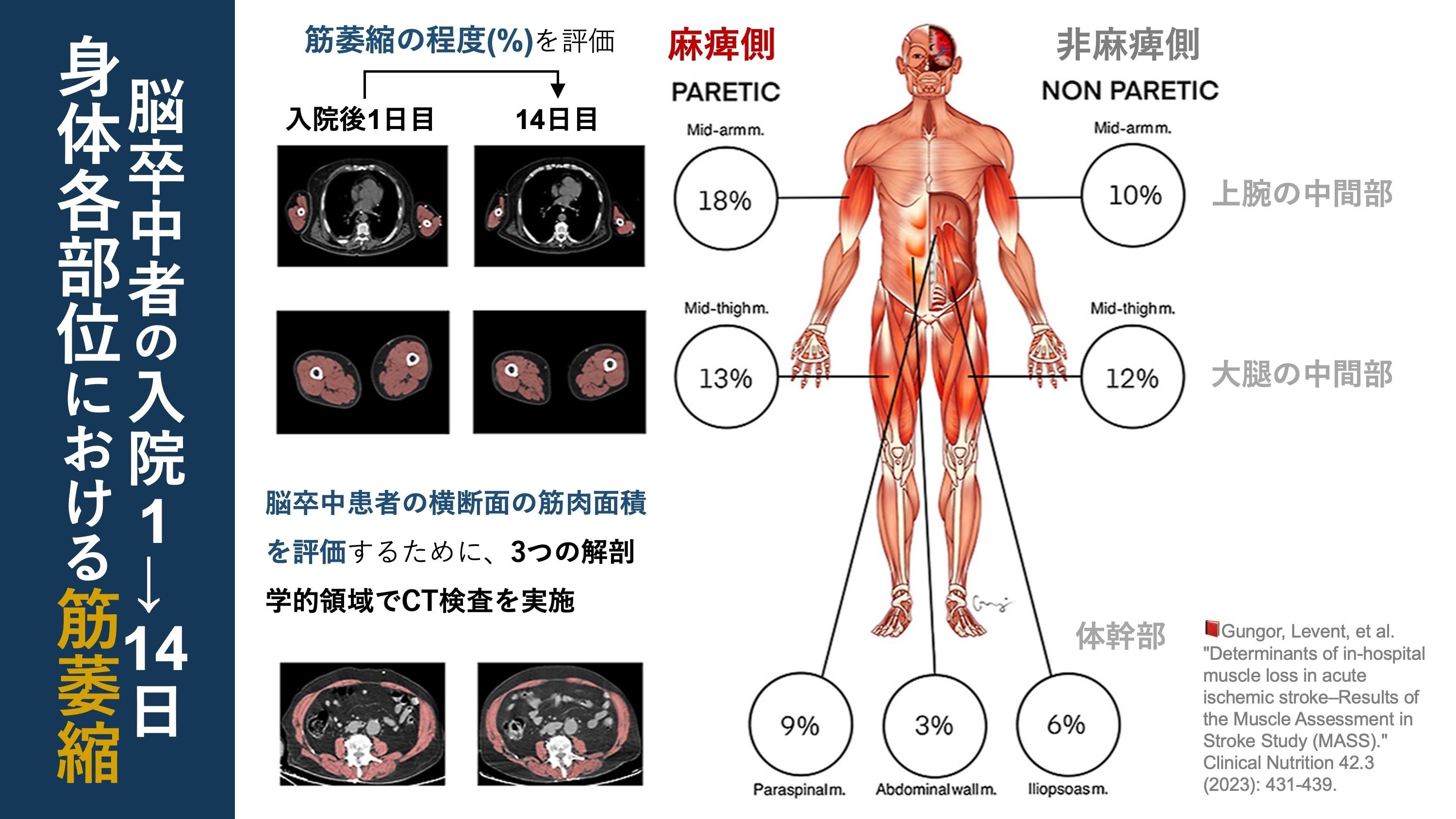 筋肉反射応用治療学 Amazon.co.jp: 新装改訂版 1からわかる!キネシオロジー: 筋肉