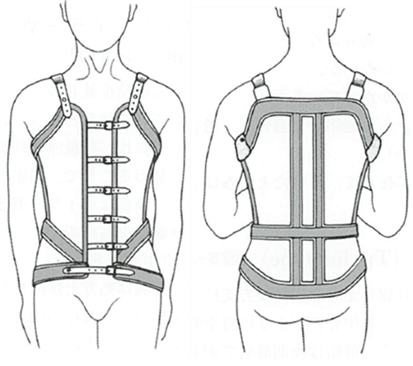 理学療法士 国家試験対策 胸腰仙椎装具｜じょんがらPT