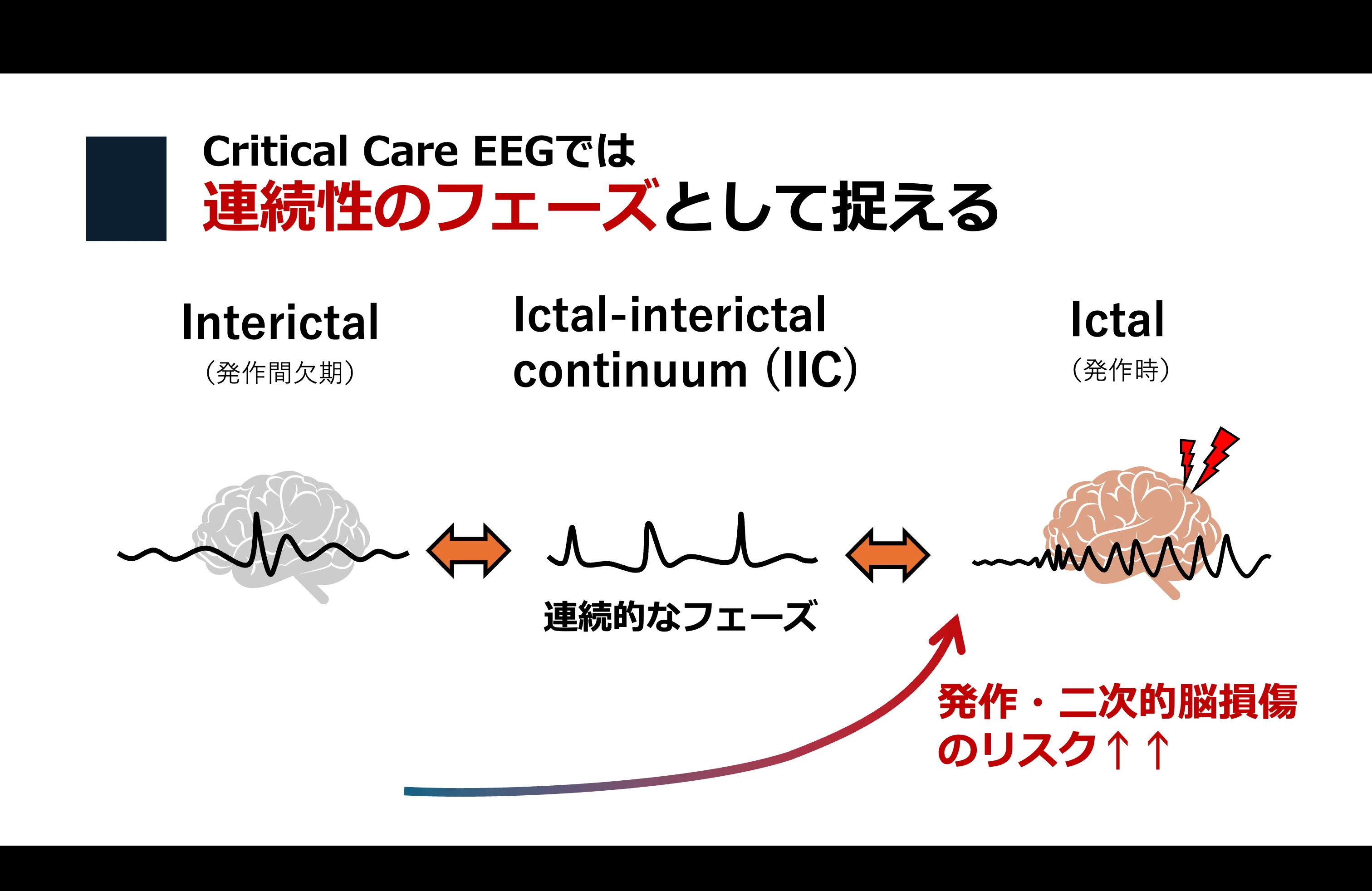 てんかん重積のperiodic dischargeはCRPみたいなもの｜はじめての