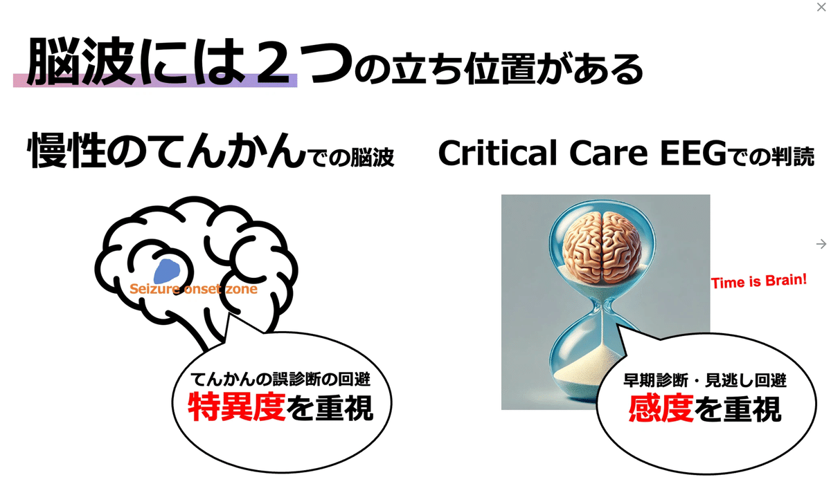 てんかん重積のperiodic dischargeはCRPみたいなもの｜音成