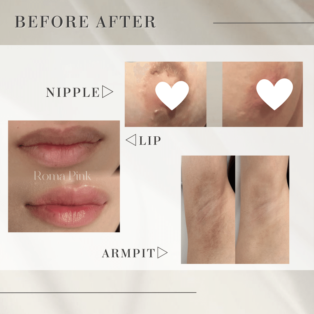 Roma Pink ローマピンク シルバー Roma Pink Lip アフター