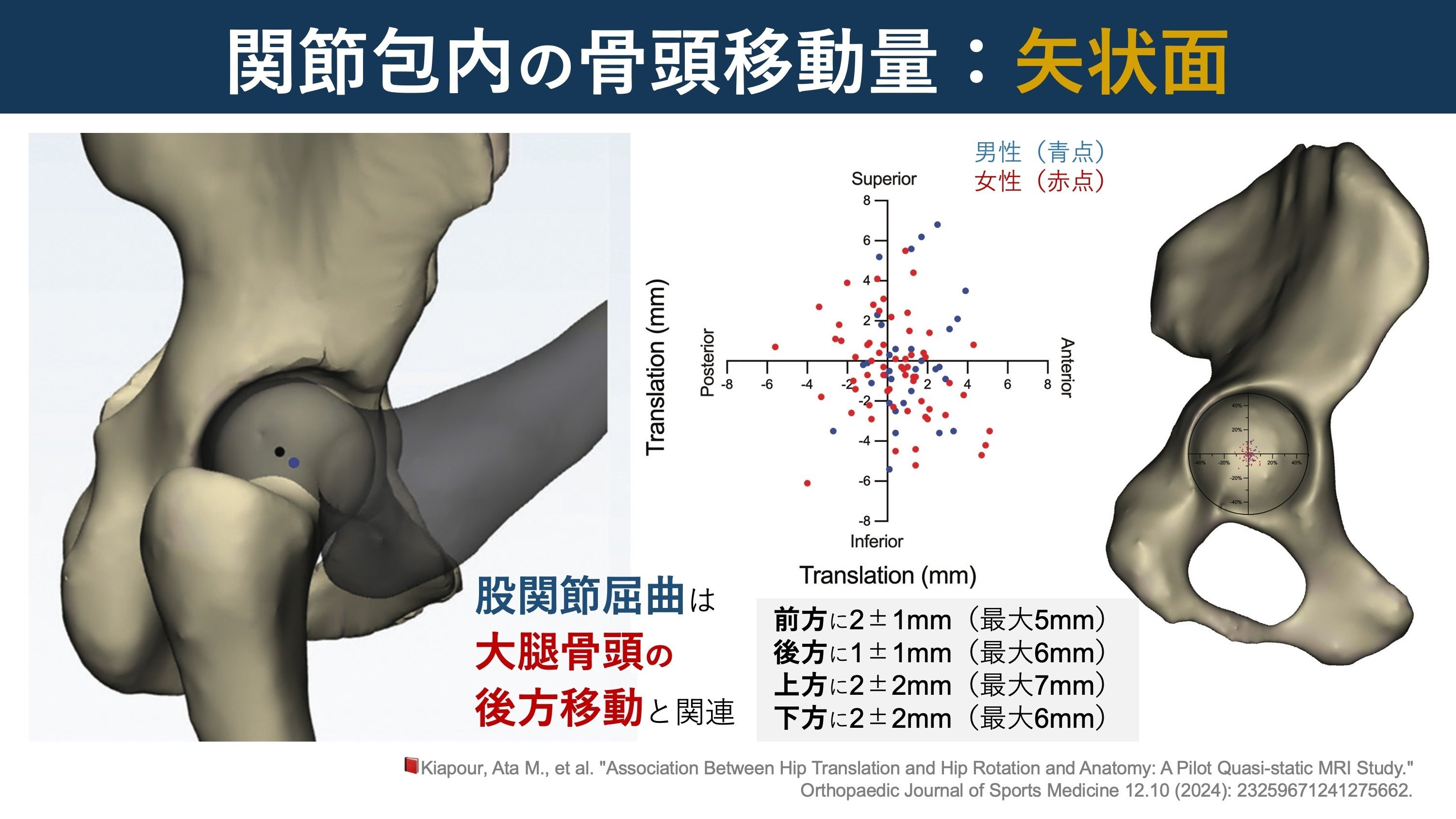 股関節運動時の大腿骨頭移動量｜Super Human | 理学療法士／保健