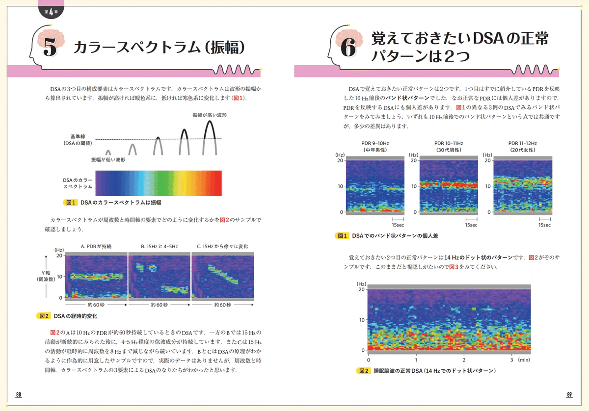 はじめての脳波トリアージ: 2ステップで意識障害に強くなる | 音