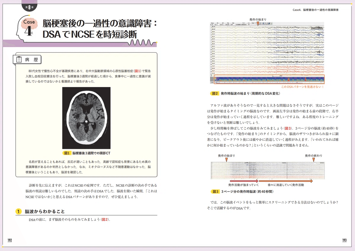 脳波で診る救命救急—意識障害を読み解くための脳波ガイドブック