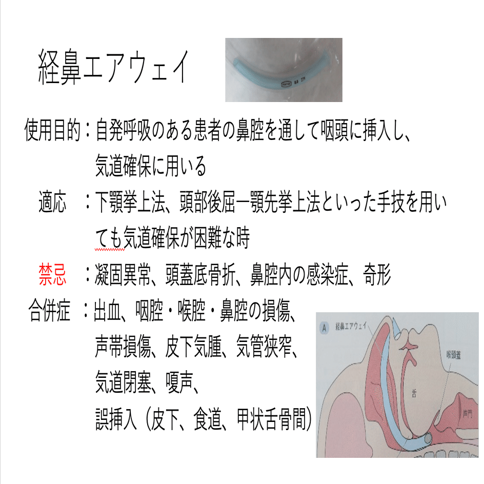 【気道確保】意識下挿管_エアウェイスコープ, image size:1682x944