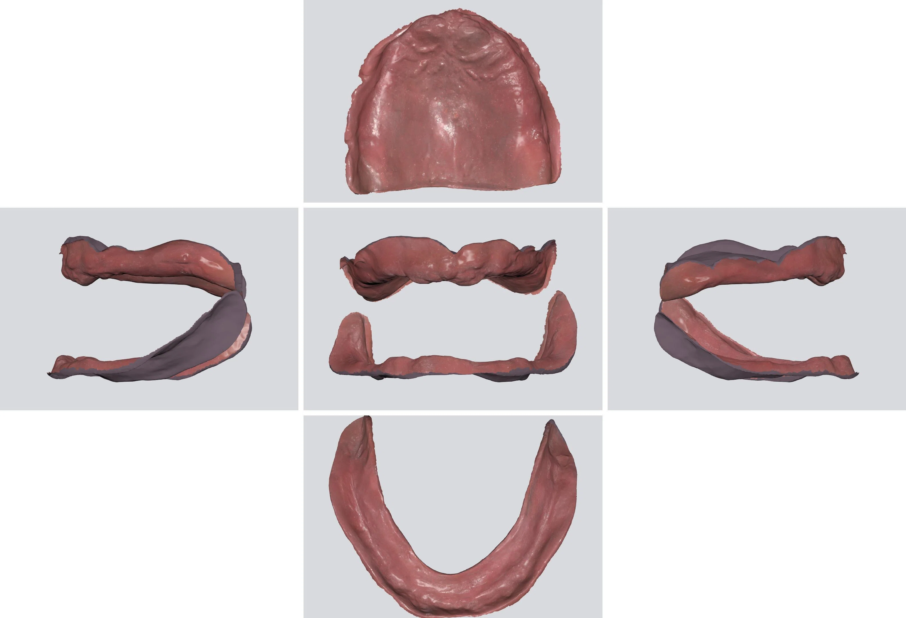 Create from scratch! Try-in dentures made with Medit's simple CAD! You ...