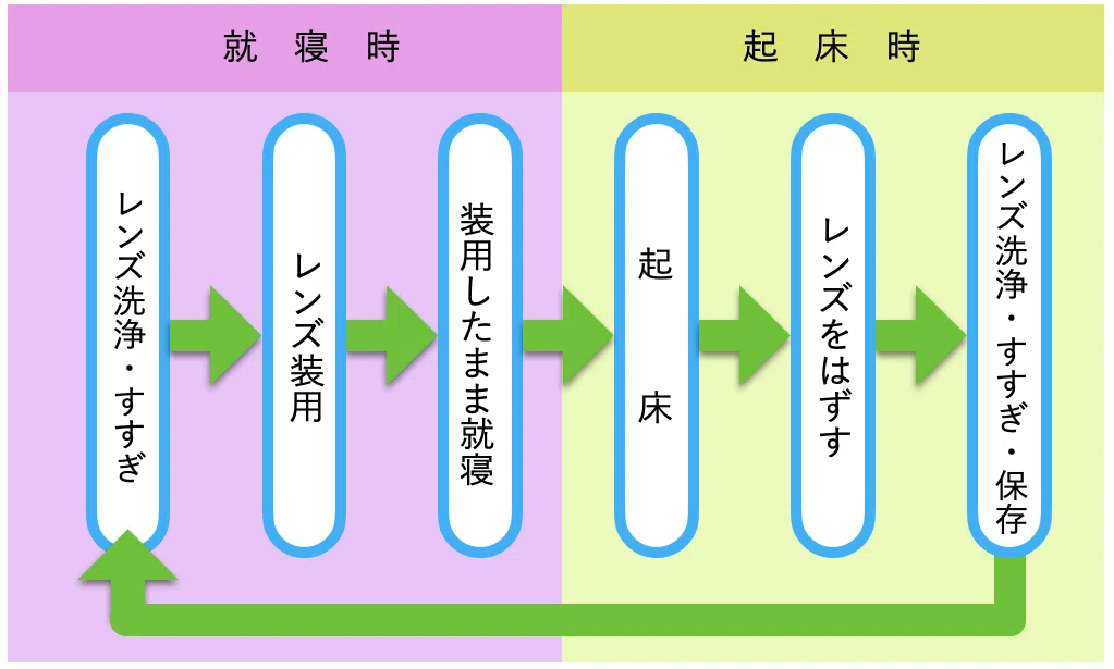 オルソケラトロジーレンズの治療スケジュールとメニコンオルソK®の
