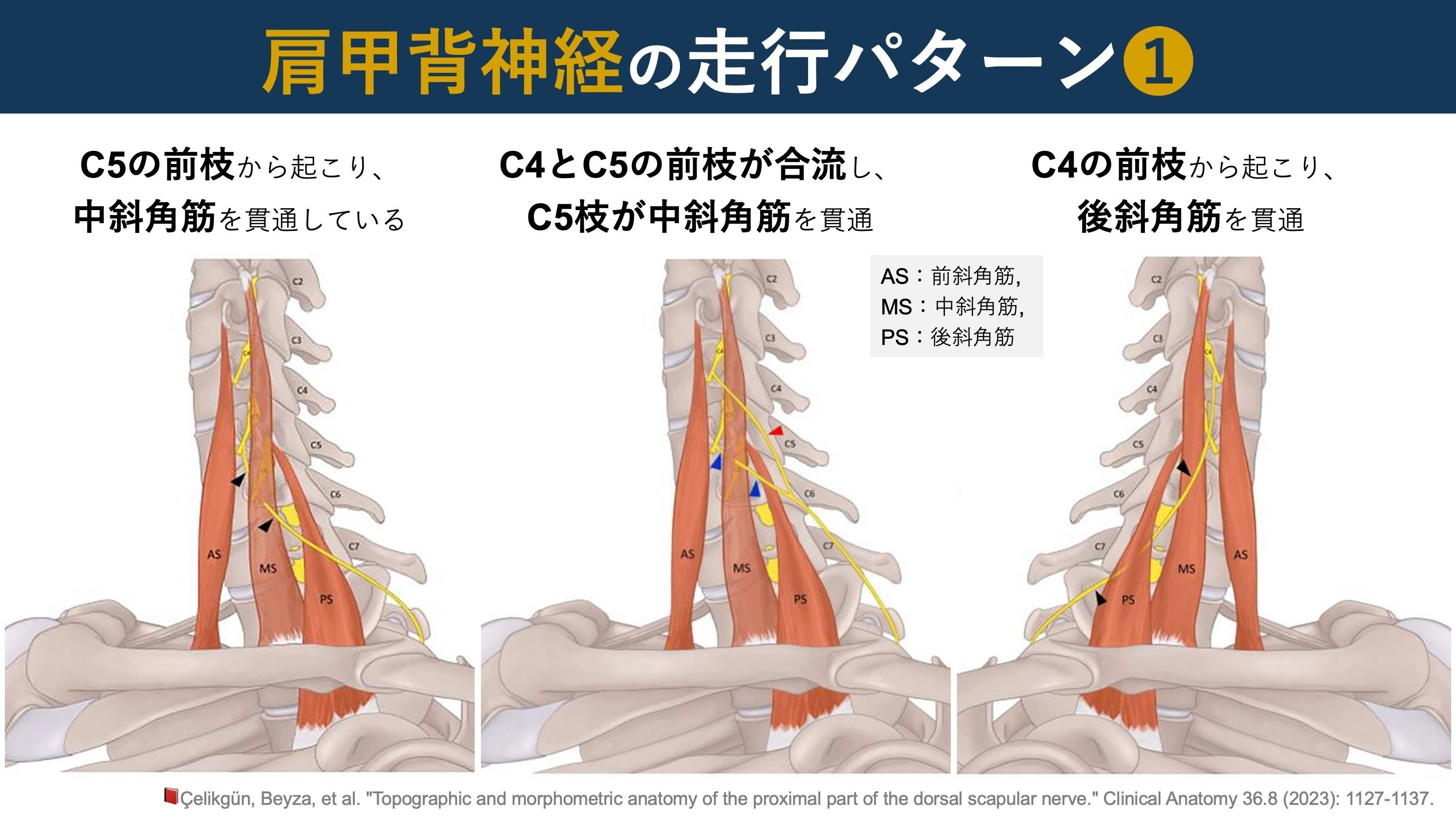 肩甲背神経を見よ！｜Super Human | 理学療法士／保健学博士 Ph.D.