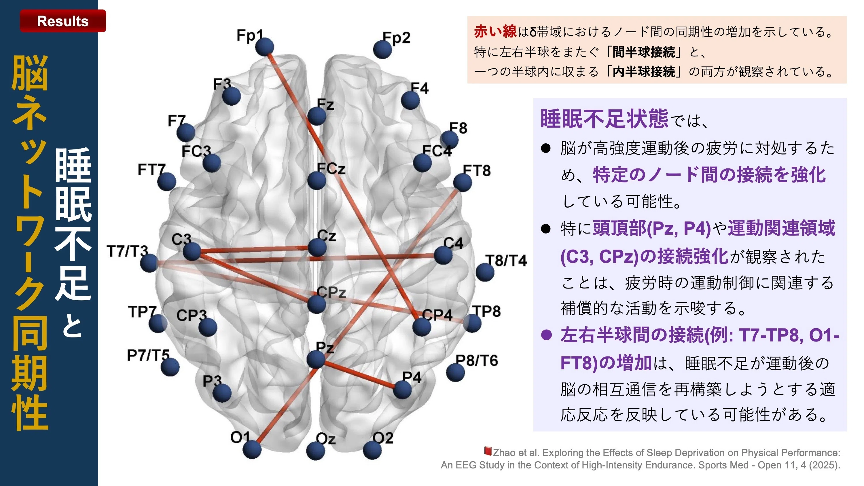 睡眠不足による全身持久力、脳波への影響｜Super Human | 理学療法士