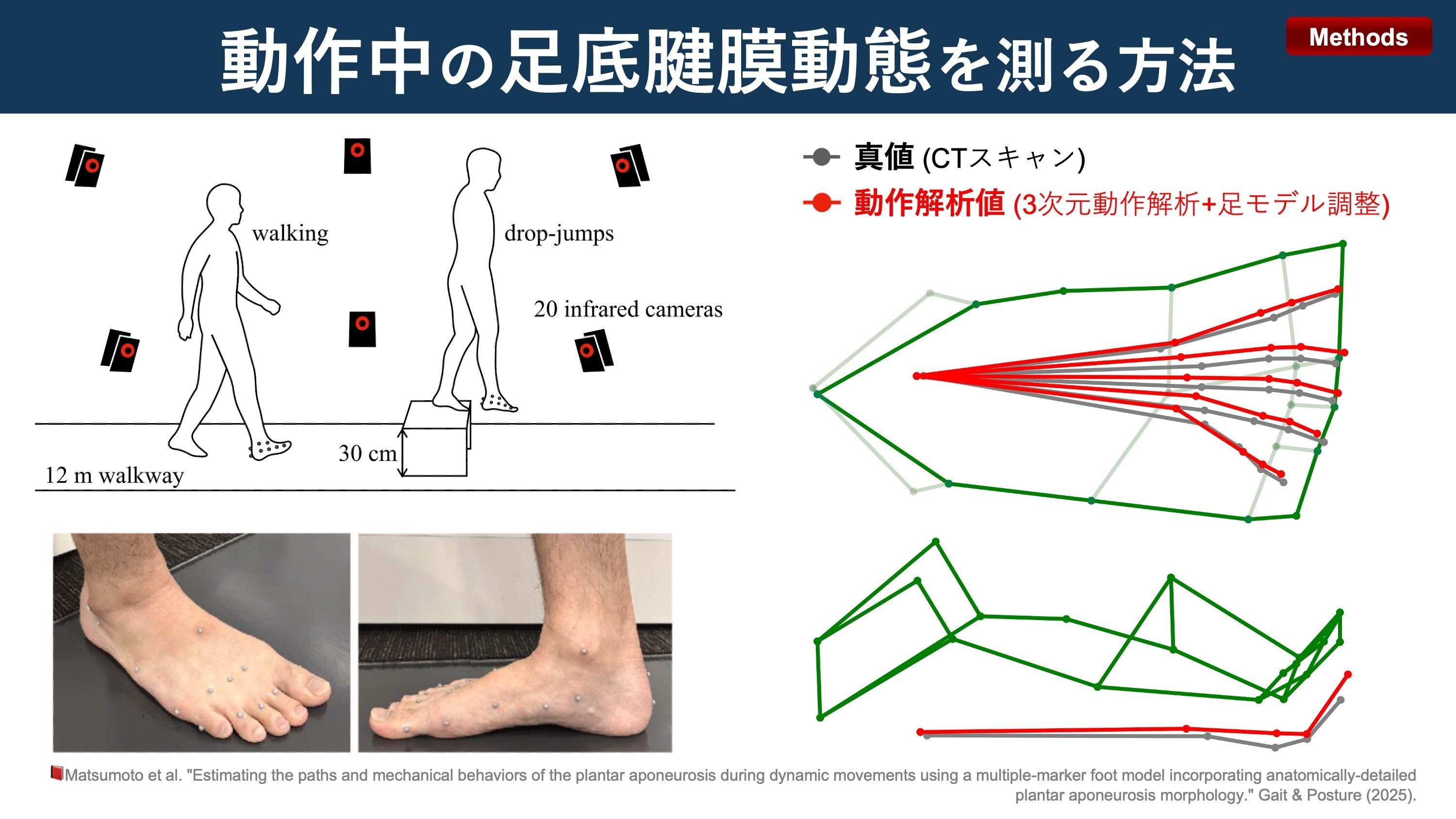 動作中の足底腱膜｜Super Human | 理学療法士／保健学博士 Ph.D.