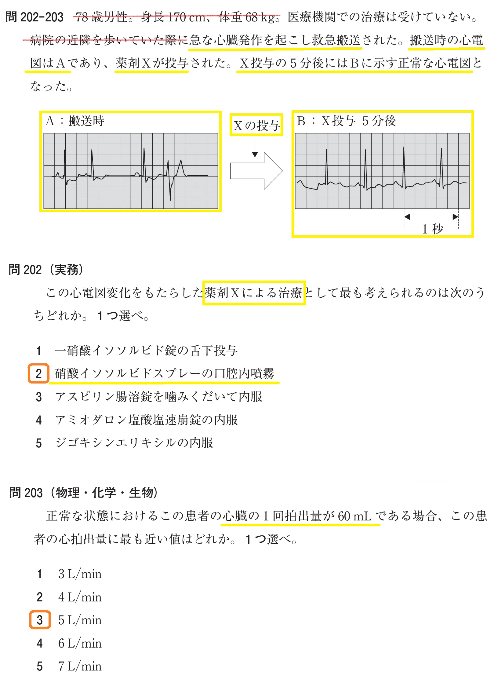 無脈性心室頻拍とは？血圧低下の仕組みとVF移行リスク・除細動の判断基準を徹底解説(01)