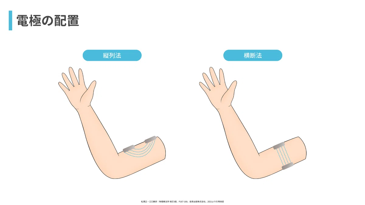 うまく電気が流れない・・・それ、電極の貼付で改善するかもしれません！｜サギョウ先生