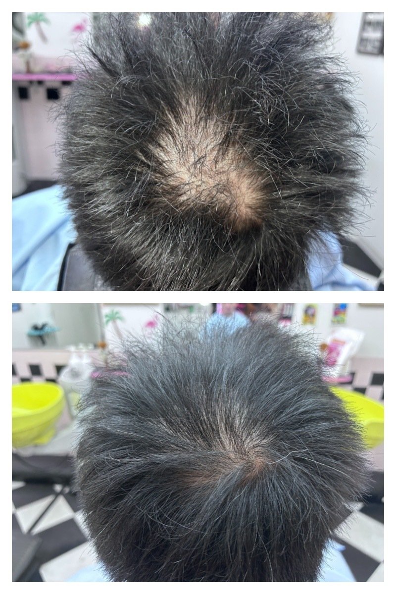 増毛エクステ コンビニつけ毛 は、薄くなった髪の毛を取り戻す増毛法