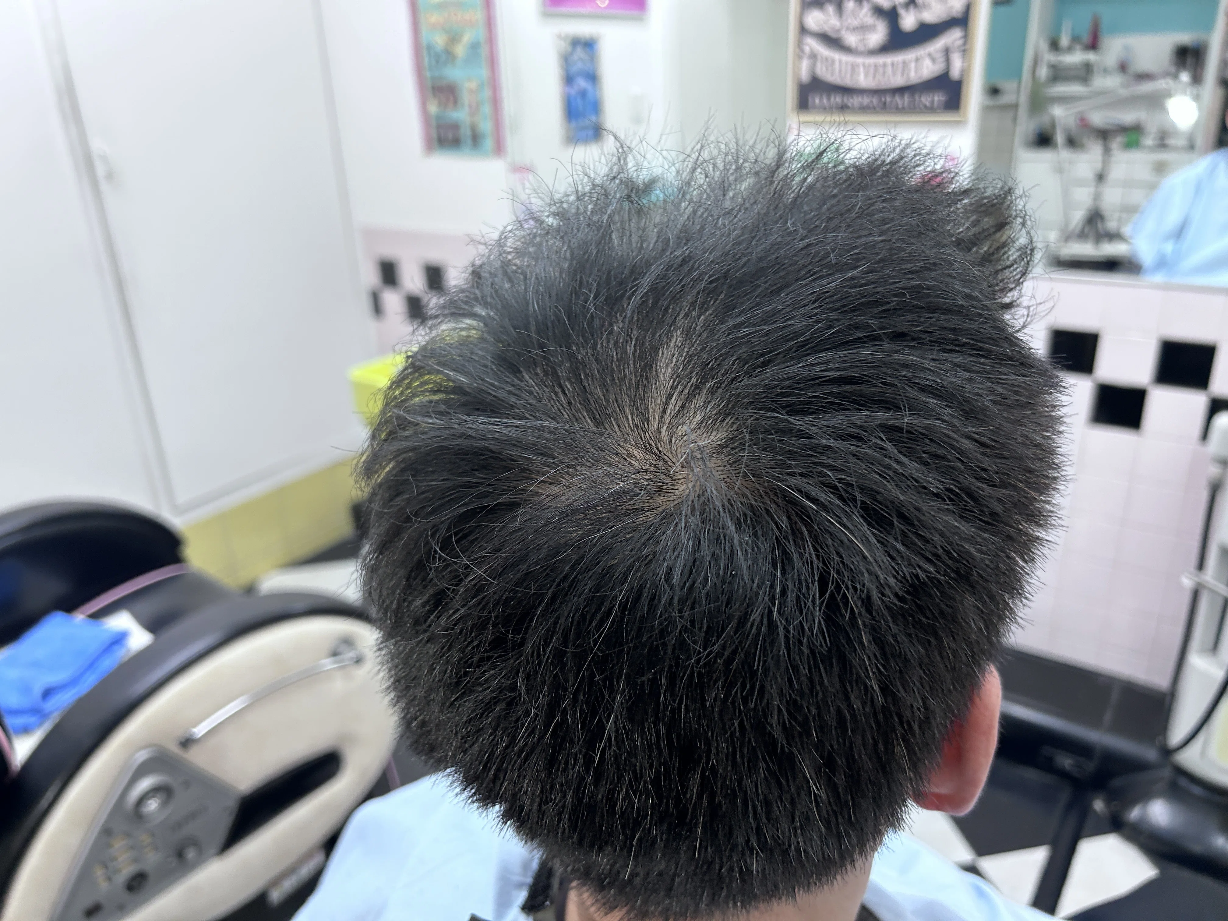 増毛エクステ コンビニつけ毛 は、薄くなった髪の毛を取り戻す増毛法