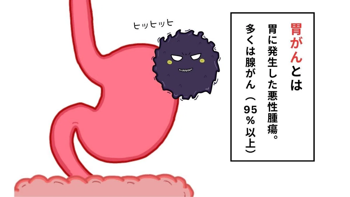 【胃がんの症状や特徴】イラスト図解でわかりやすく解説!|おがちゃん先生/解剖生理