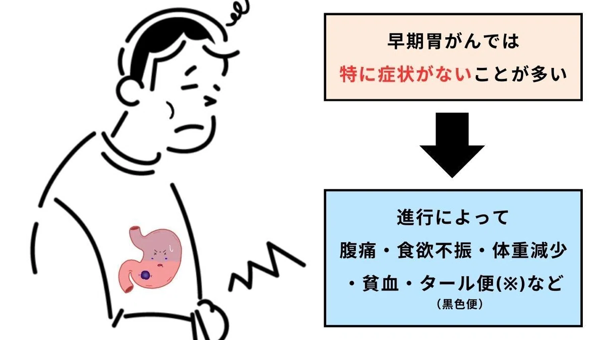 【胃がんの症状や特徴】イラスト図解でわかりやすく解説!|おがちゃん先生/解剖生理