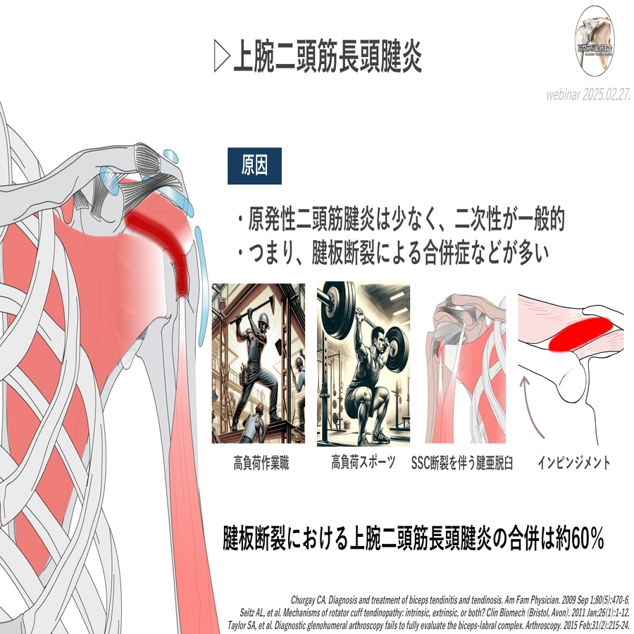 エビデンスに基づく上腕二頭筋長頭腱炎｜肩関節機能研究会 郷間