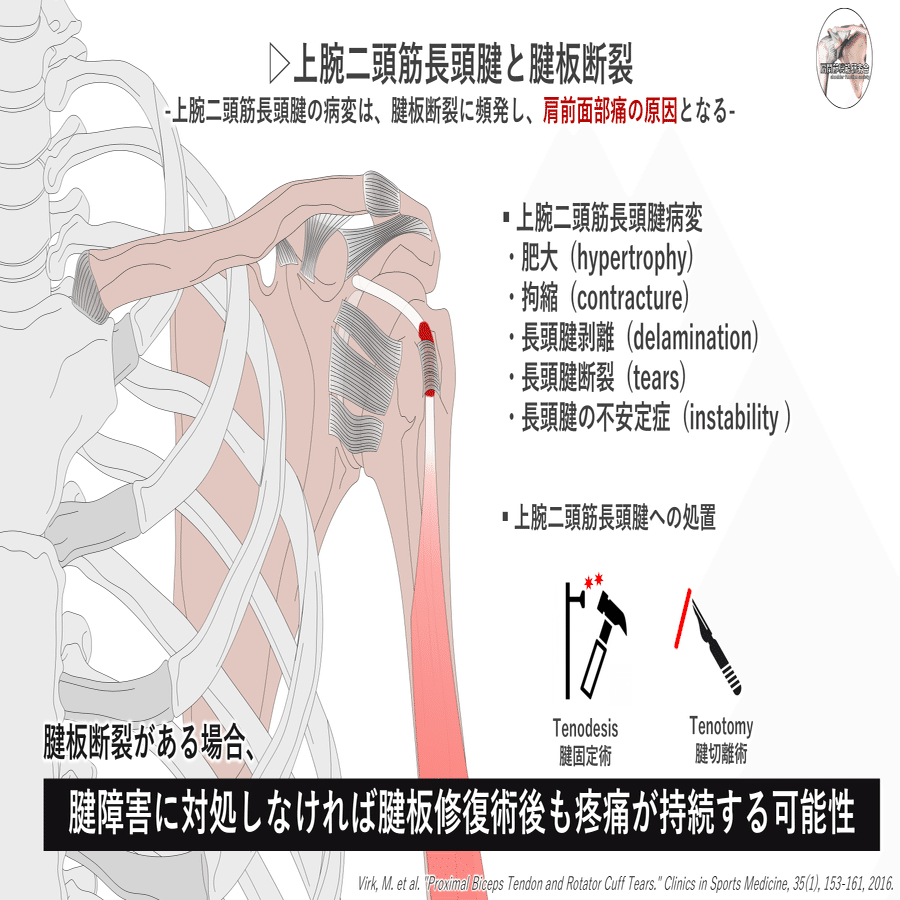 エビデンスに基づく上腕二頭筋長頭腱炎｜肩関節機能研究会 郷間