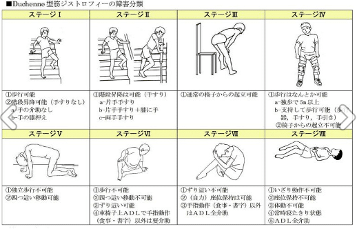 第60回理学療法士国家試験 午前6−10の解説｜Sixty_valleyのページ