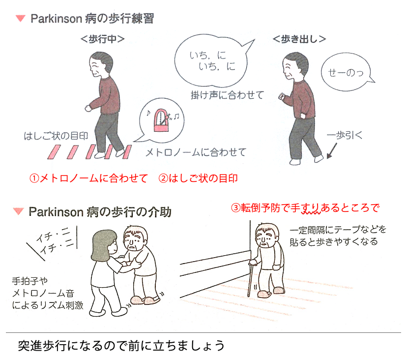 パーキンソン病の理学療法　第２版 パーキンソン病の理学療法 第2版 | 奈良 勲, 松尾 善美, 石井