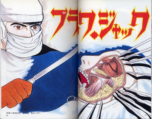 手塚治虫『ブラック・ジャック』少年チャンピオン・コミックス新装版の