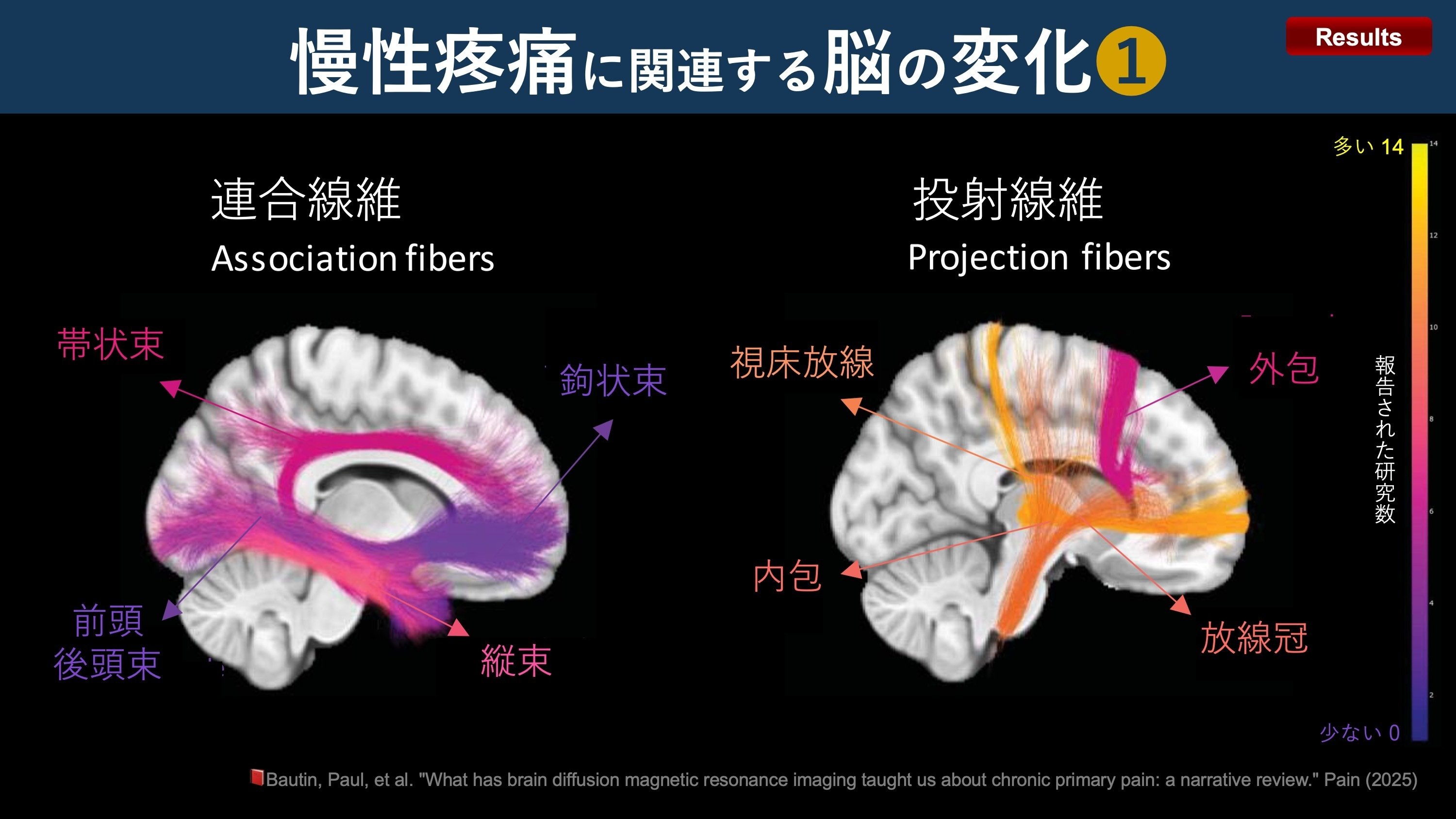 Amazon.co.jp: 問題形式で学ぶ区域麻酔と疼痛治療 : ハ-マン