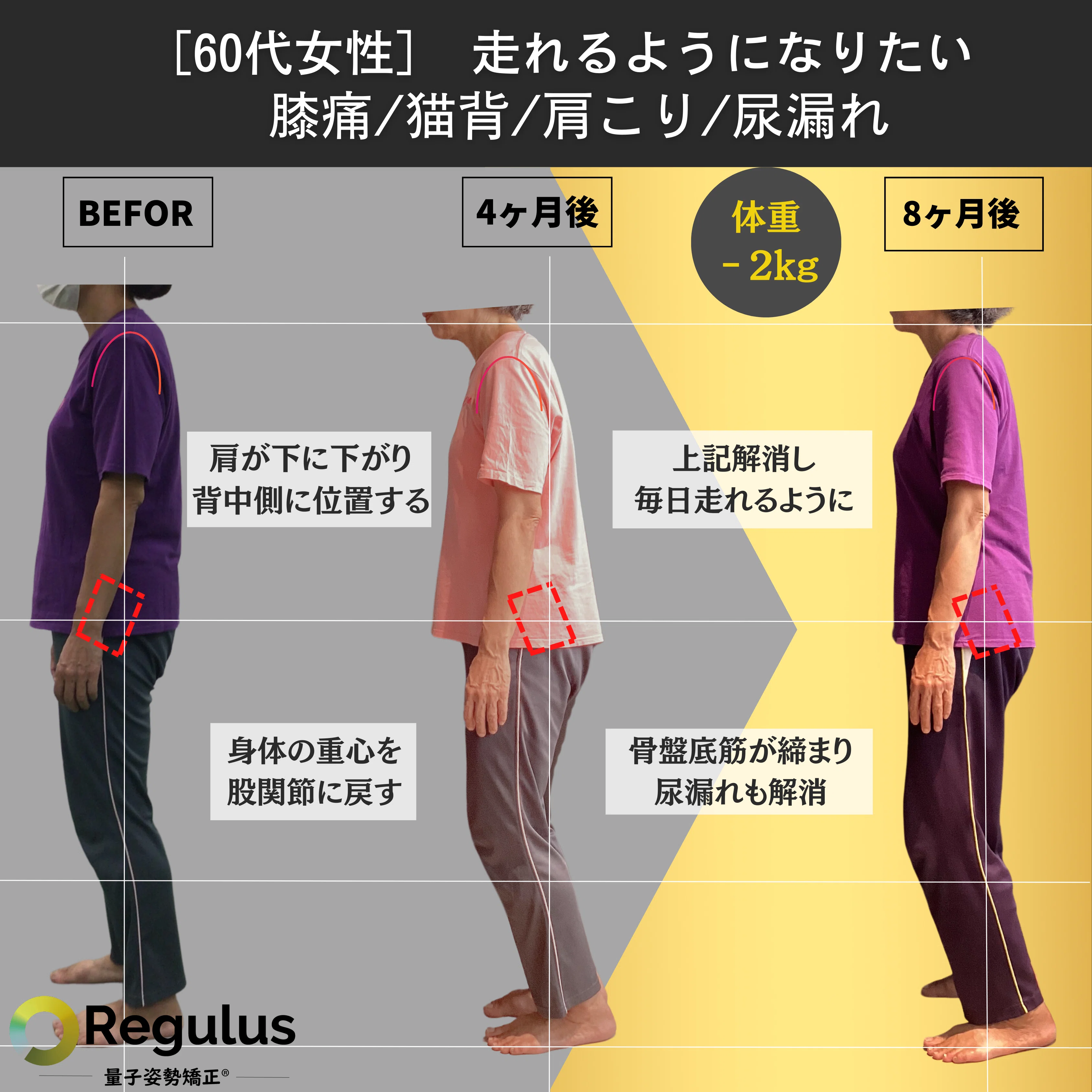 尿漏れ解消】エクササイズだけじゃ治らない！骨盤底筋を締める正しい 