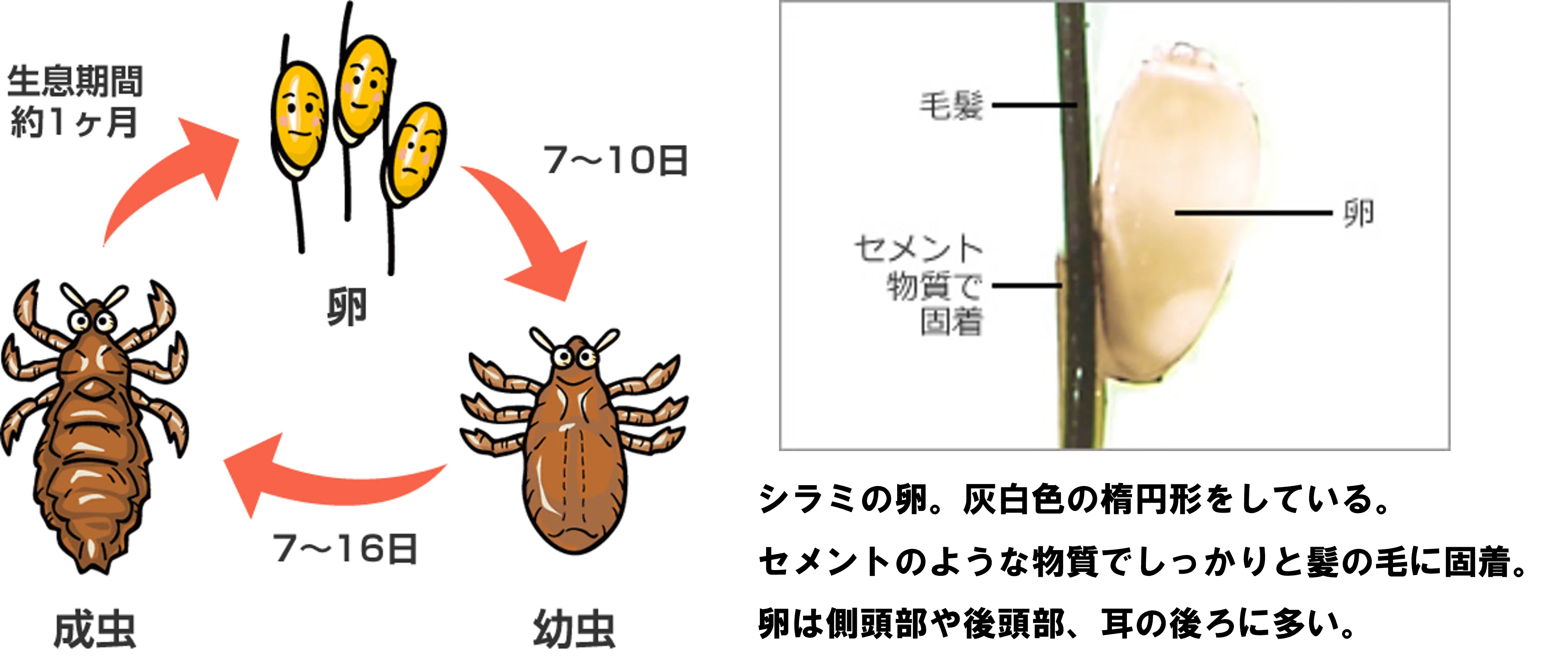 シラミ いるか どうか