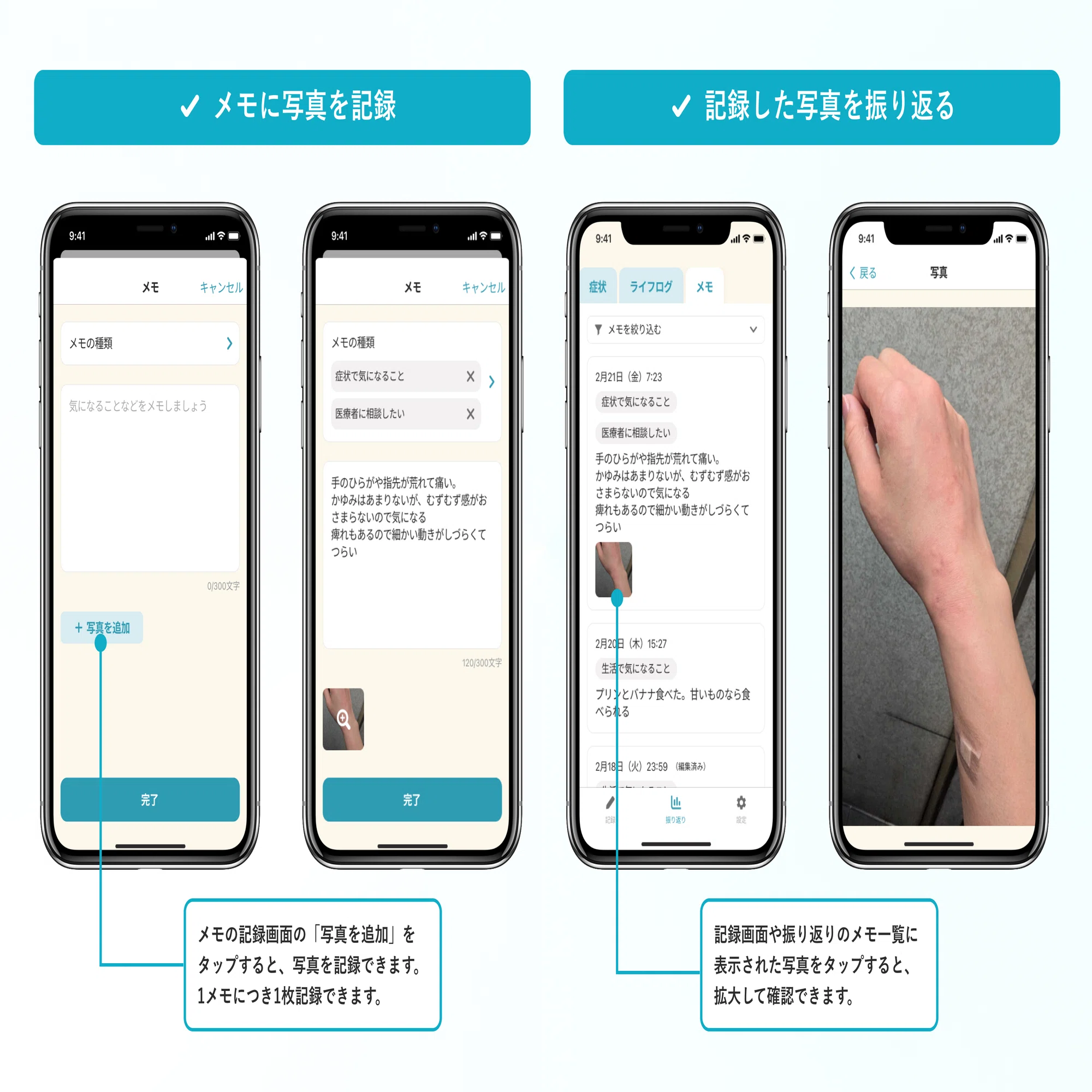 新機能】ハカルテに「写真登録機能」を追加しました！｜ハカルテ（がん 
