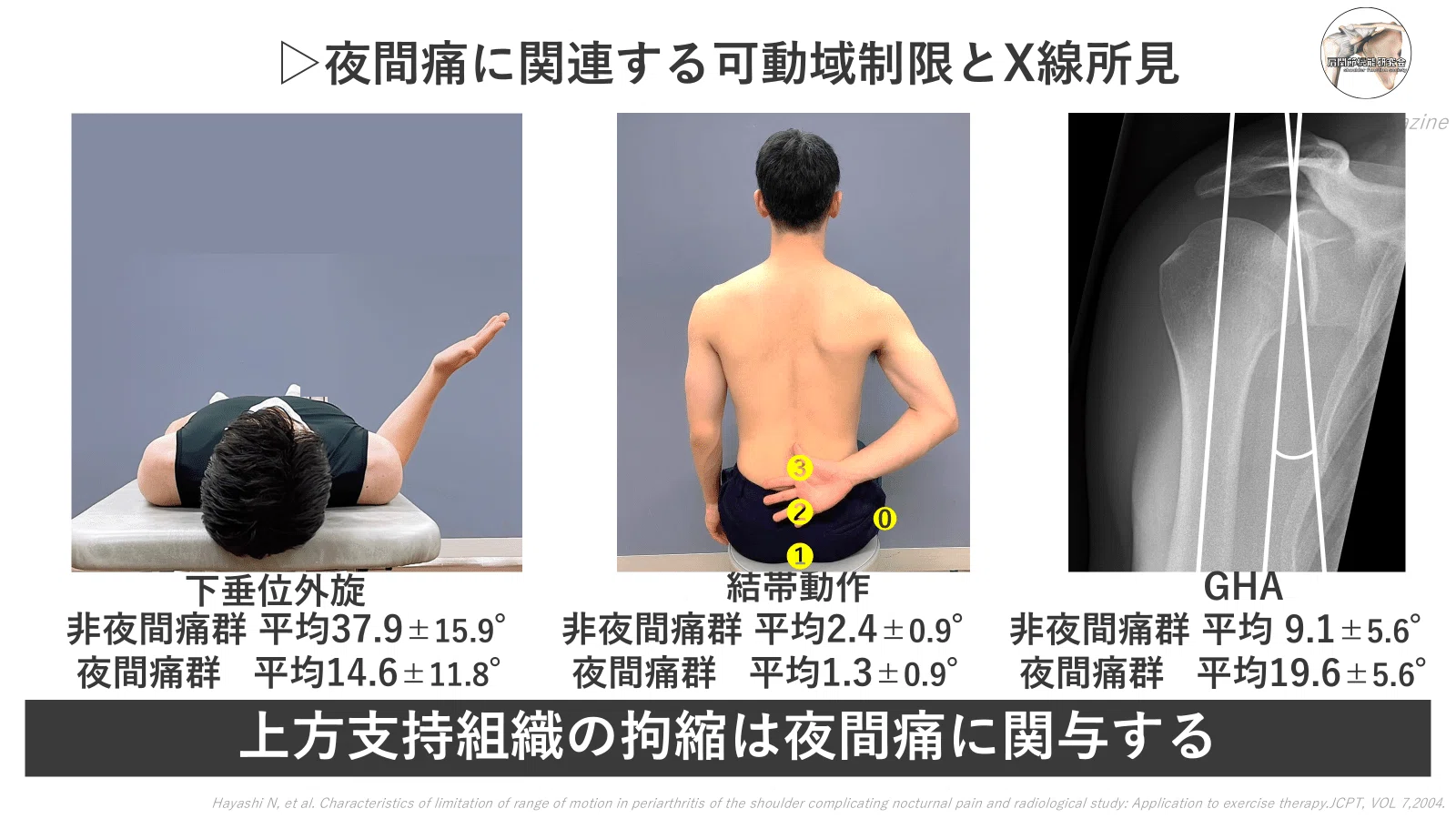 夜間痛に対する上方組織への有効なアプローチ【買い切り版】｜肩関節